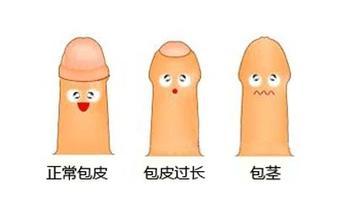 苏州包皮手术医院