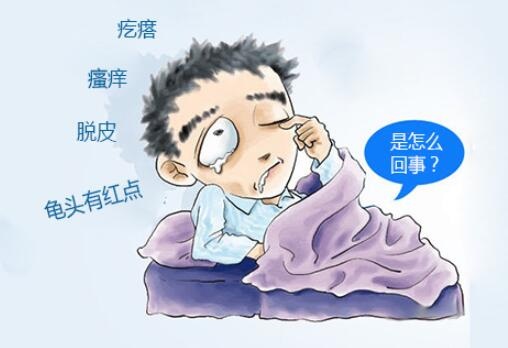 苏州治疗龟头炎医院