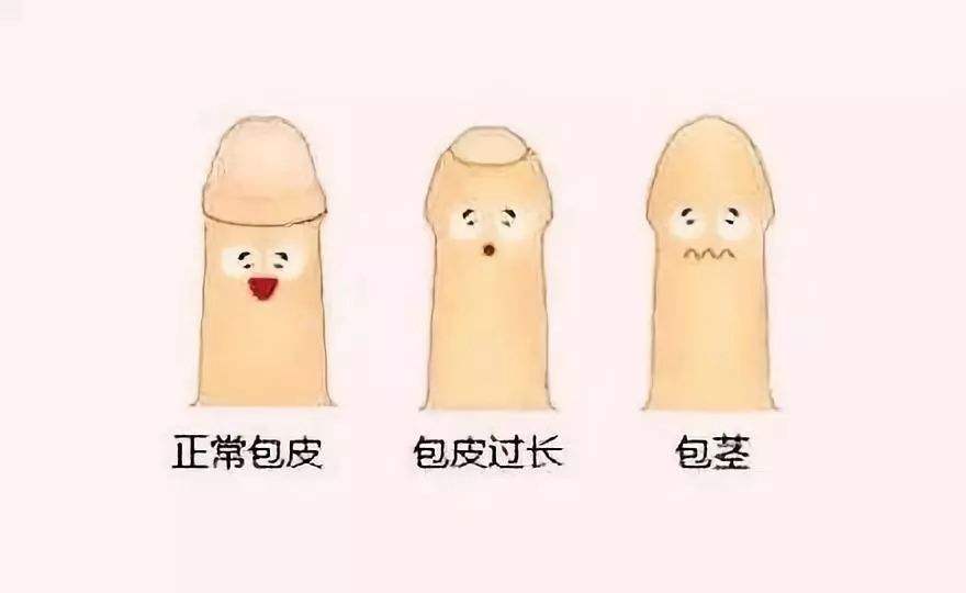 苏州哪家医院做包皮手术好