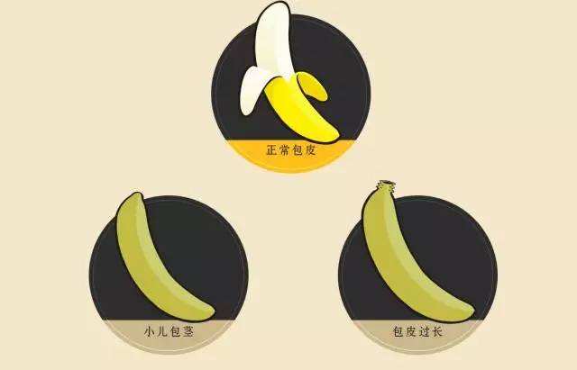 苏州包皮手术哪里较好