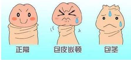 苏州包皮手术哪家医院好