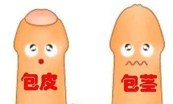 包皮手术费一般多少钱